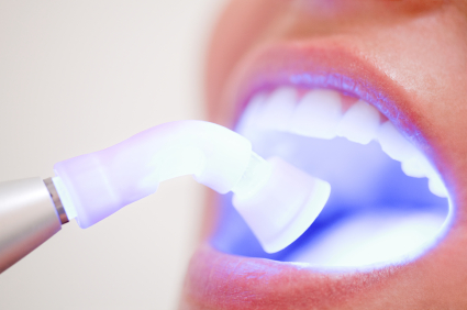 Ask your dentist about tooth whitening treatments