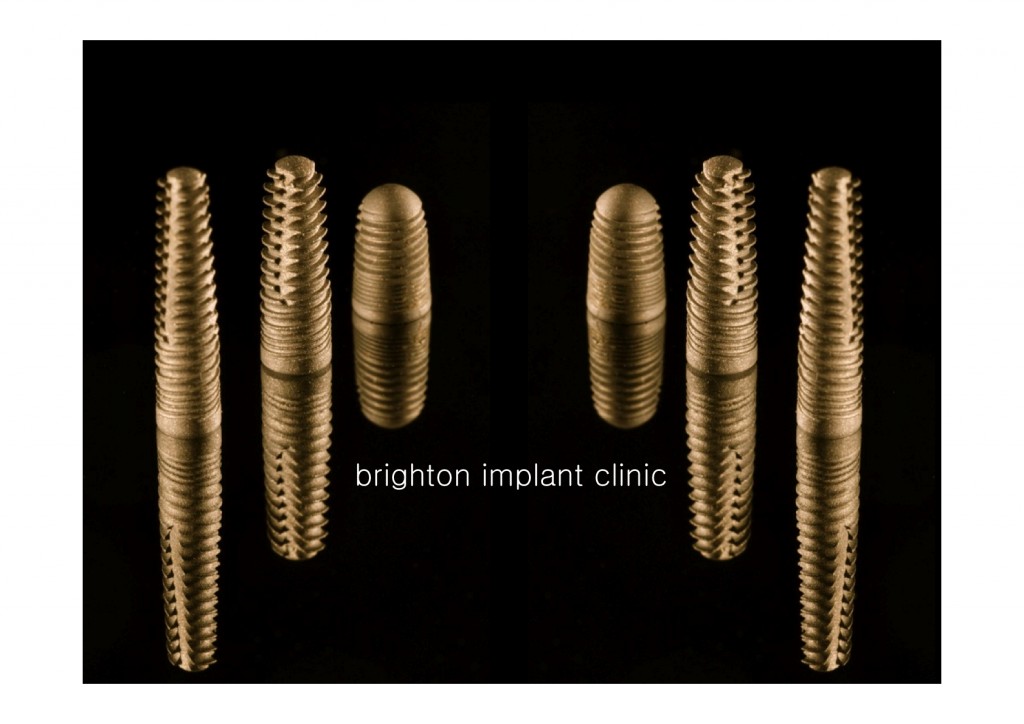 Titanium implants 2