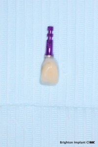 Dental Implantology
