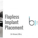 neodent dental implants 1