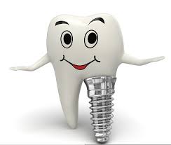 Dental Implant Treatment in Brighton