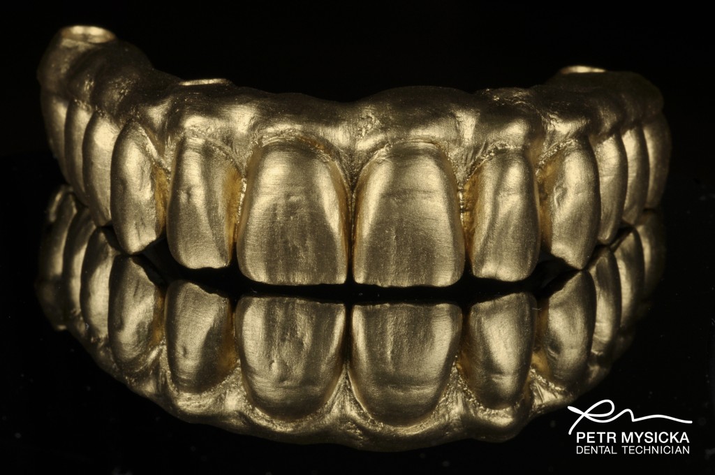 gold powder used in dental laboratory