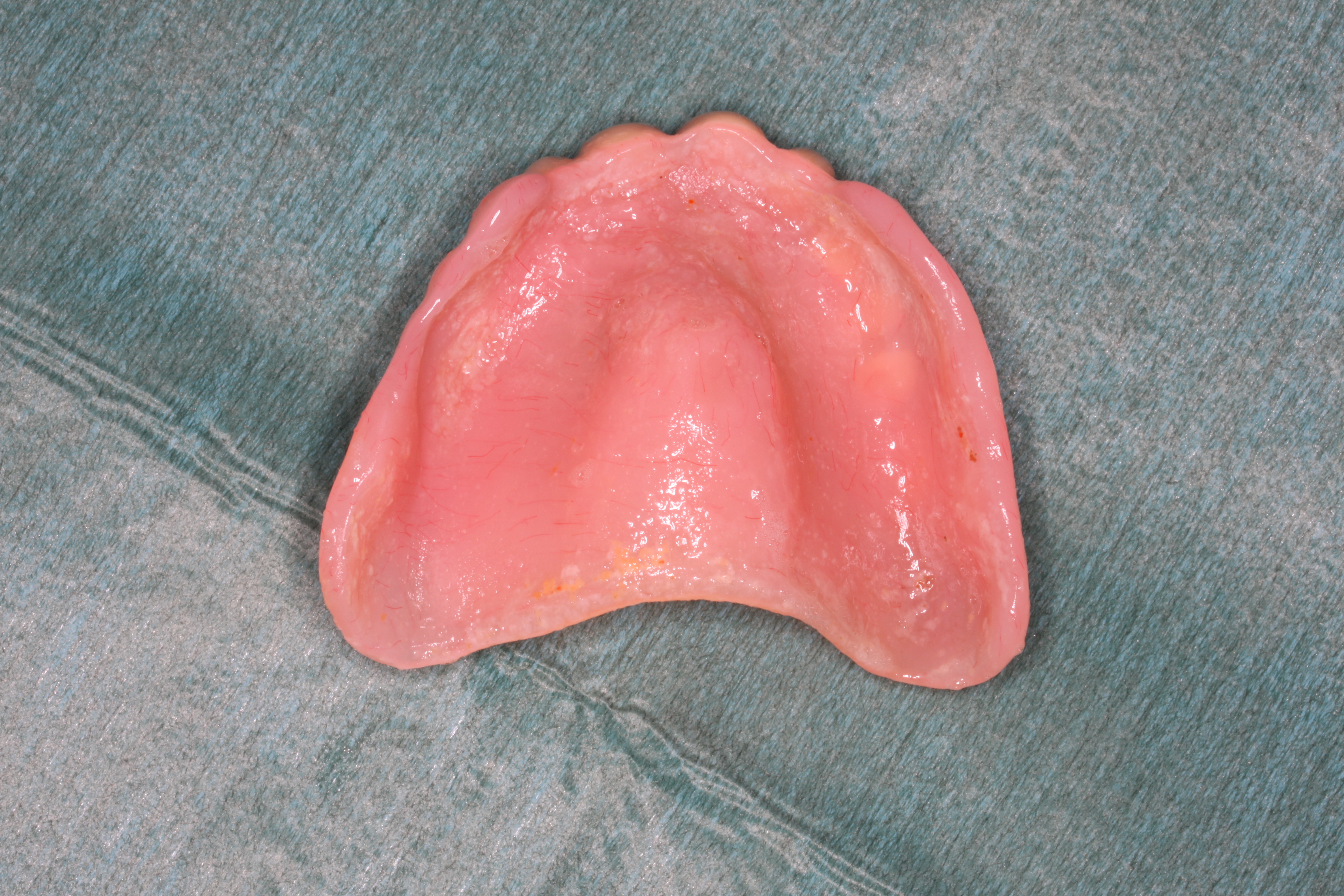 Clean fitting surface of full upper denture