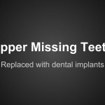 Missing teeth - Brighton Implant Clinic phase1