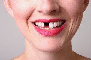 Flossing helps prevent gum disease